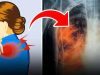 Tyto 3 typy bolesti mohou upozornit na rakovinu plic. Mnoho lidí je přehlíží a přisuzuje je běžným potížím